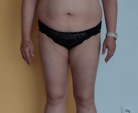 Fotografie po úpravě