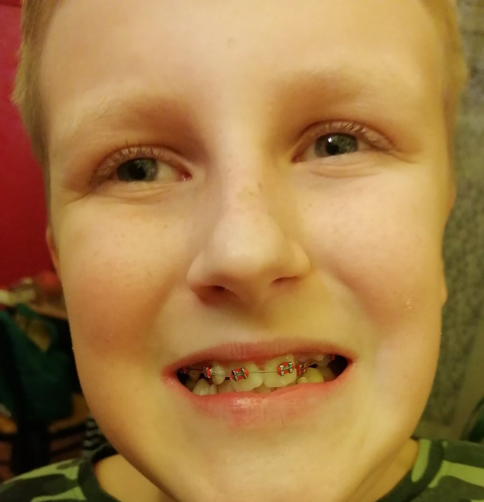 Fotografie před úpravou